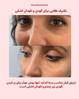 تصویر گالری فاطمه بابائی پور 2