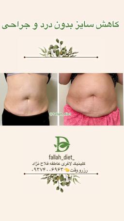 تصویر گالری عاطفه فلاح نژاد 5