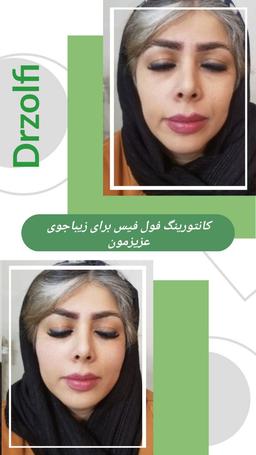 تصویر گالری محمدعلی زلفی 4