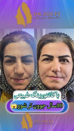 تصویر گالری محمدعلی زلفی 3