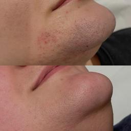 تصویر گالری ملیکا محمدزاده 12