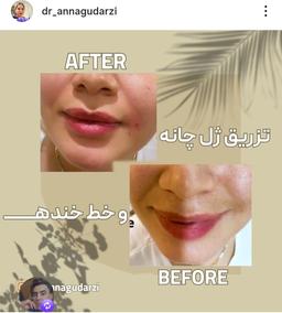 تصویر گالری آنا گودرزی 14