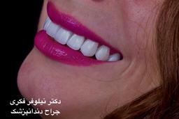 تصویر گالری نیلوفر فکری 4