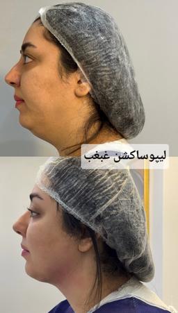 تصویر گالری زهرا ابراهیمی 8