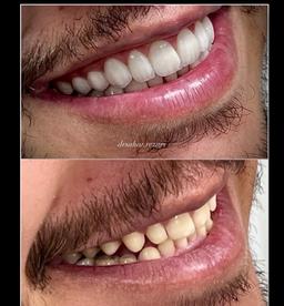 تصویر گالری سحر رضائی 4