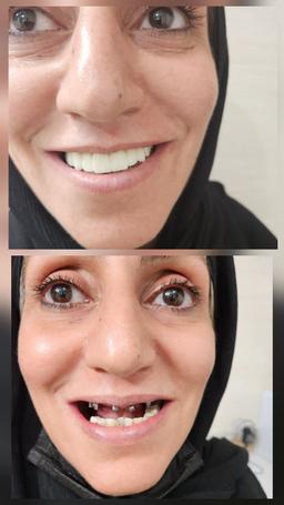 تصویر گالری فاضل رحمانیان 2