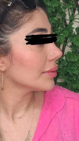 تصویر گالری آیدین غفاری 5