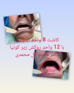 تصویر گالری محمد گل محمدی 2