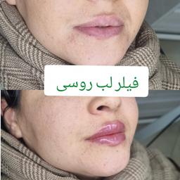 تصویر گالری آروین برهانی 1