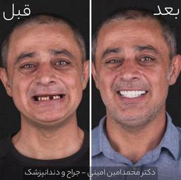 تصویر گالری سیدمحمدامین امینی 3