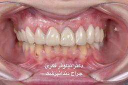 تصویر گالری نیلوفر فکری 9