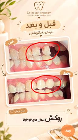 تصویر گالری کوثر خسروی 4