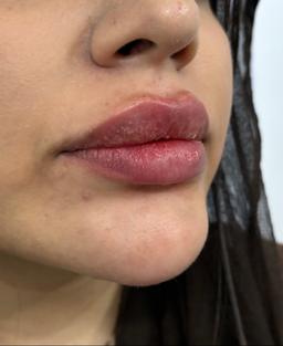 تصویر گالری سیما یاراحمدی 1