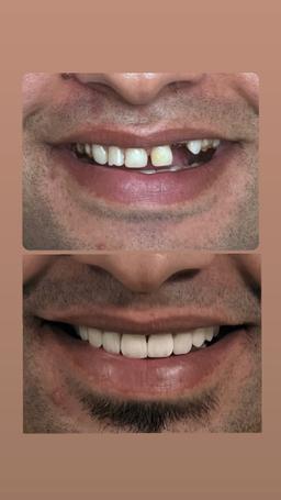 تصویر گالری سحر رضائی 2