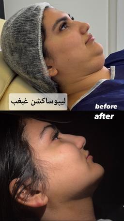 تصویر گالری زهرا ابراهیمی 4