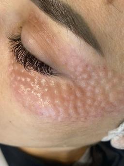 تصویر گالری ملیکا محمدزاده 18