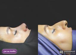 تصویر گالری دکتر حمیدرضا راستی 12