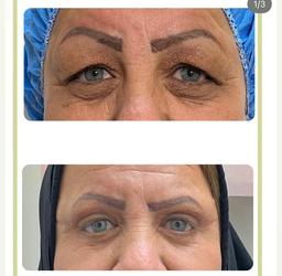 تصویر گالری رضا نوتاش 5