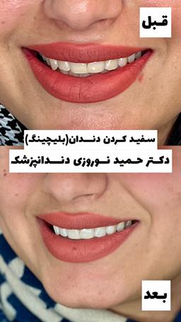 تصویر گالری حمید نوروزی 4