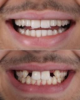 تصویر گالری هومن باقری 3