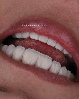 تصویر گالری شیما سرلک 1