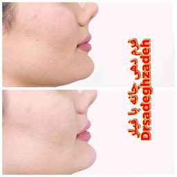 تصویر گالری حسن صادق زاده 4