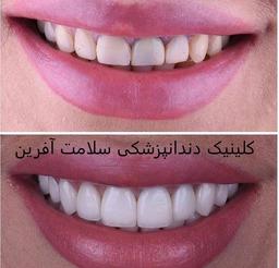 تصویر گالری سامان ایزدپناه 2