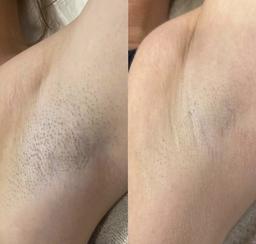 تصویر گالری ملیکا محمدزاده 20