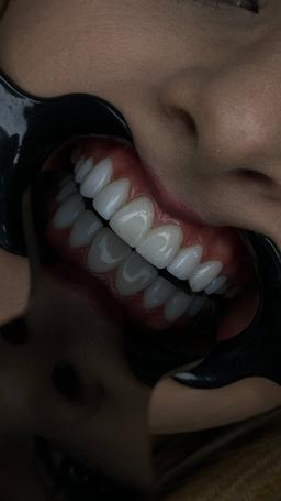 تصویر گالری افشین ورمزیار 3