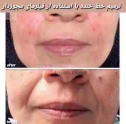 تصویر گالری محمد نورابی 7