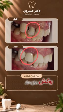 تصویر گالری کوثر خسروی 5