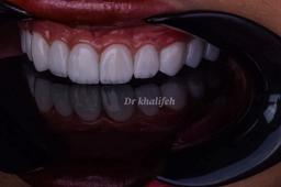 تصویر گالری پریسا خلیفه 3