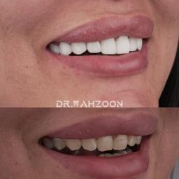 تصویر گالری طناز محزون 2