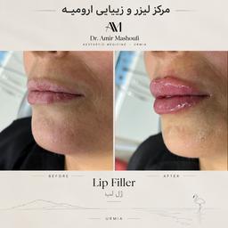تصویر گالری امیر مشعوفی 13