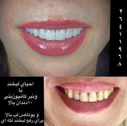 تصویر گالری زهره پناهنده 2