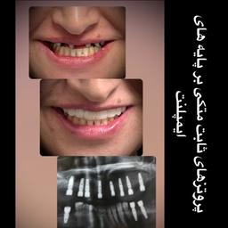 تصویر گالری سحر رضائی 6