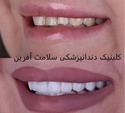 تصویر گالری سامان ایزدپناه 3