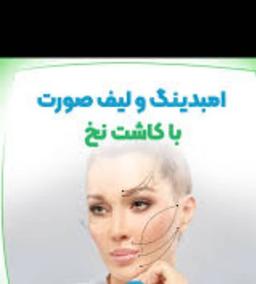 تصویر گالری پدرام غفاری نوران 11
