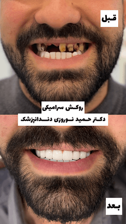 تصویر گالری حمید نوروزی 3
