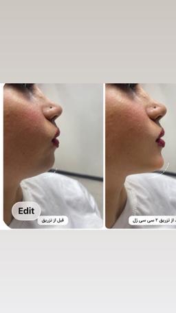 تصویر گالری علی محمد درزی بورخانی 2