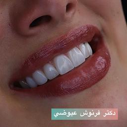 تصویر گالری فرنوش عیوضی 5