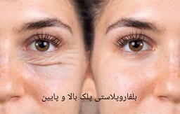 تصویر گالری مه گل فرجادنیا 7