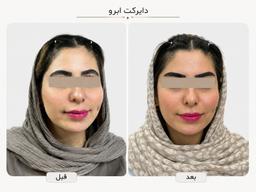 تصویر گالری آرش واحدی کشتیبان 21