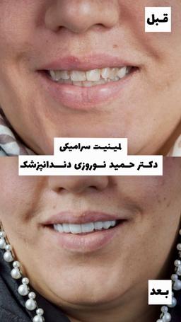 تصویر گالری حمید نوروزی 5