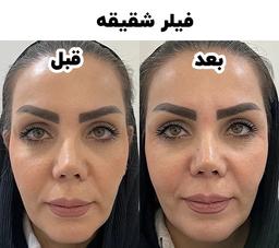 تصویر گالری حسین قلاوند 1