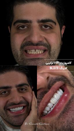 تصویر گالری سمانه سرنامه 5