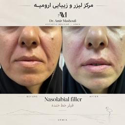تصویر گالری امیر مشعوفی 10