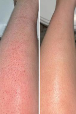 تصویر گالری ملیکا محمدزاده 13
