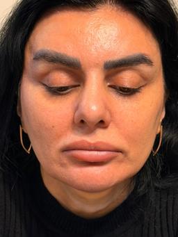 تصویر گالری فرزانه رضی آبادی 1