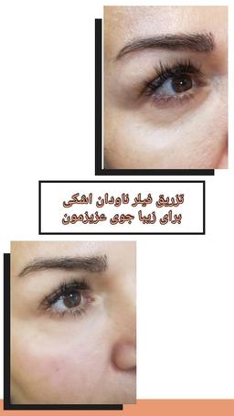 تصویر گالری محمدعلی زلفی 1